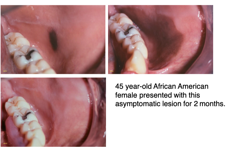 <p>women, specifically African-American</p>