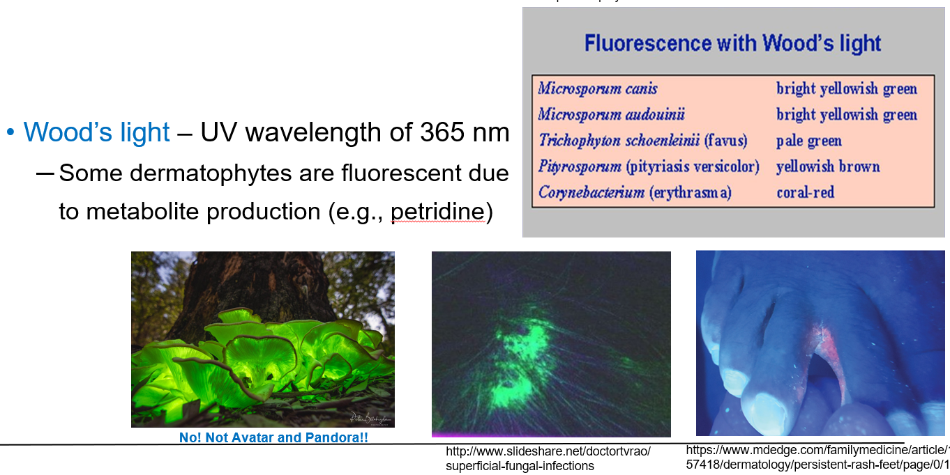<ul><li><p class=""><strong>Wood’s light</strong> is a UV light with a wavelength of <strong>365 nm</strong>.</p></li><li><p class="">It is used to detect certain <strong>fluorescent dermatophytes</strong> on the skin.</p></li><li><p class="">Some fungi glow under UV light due to <strong>metabolites</strong> like <strong>petridine</strong>.</p></li><li><p class="">Fungi like <em>Microsporum canis</em>, <em>Microsporum audouinii</em>, and <em>Trichophyton schoenleinii</em> show <strong>fluorescence</strong> and help with quick diagnosis.</p></li></ul><p></p>