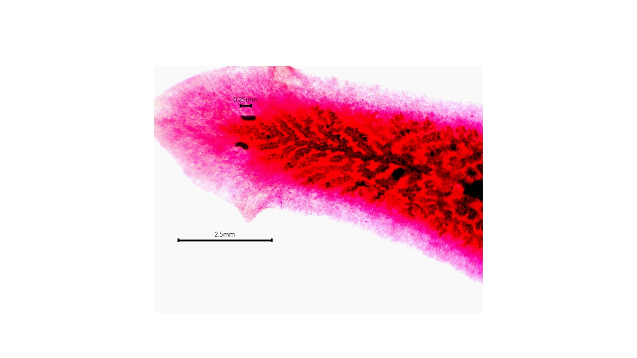 <p><span>the phylum Platyhelminthes belongs to which kingdom</span></p>