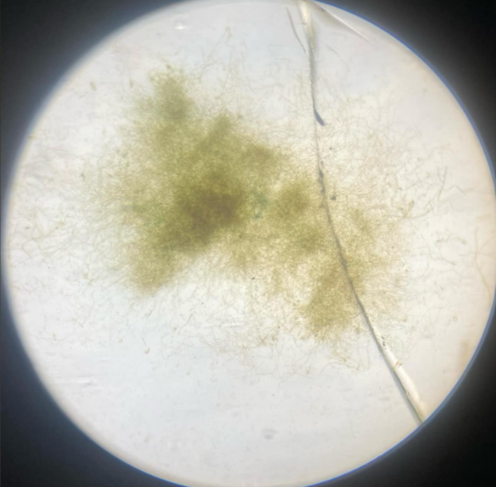 <p>Ascomycota; fungus that produces penicillin</p>