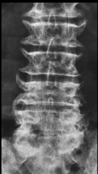 <p>what is seen here?</p>
