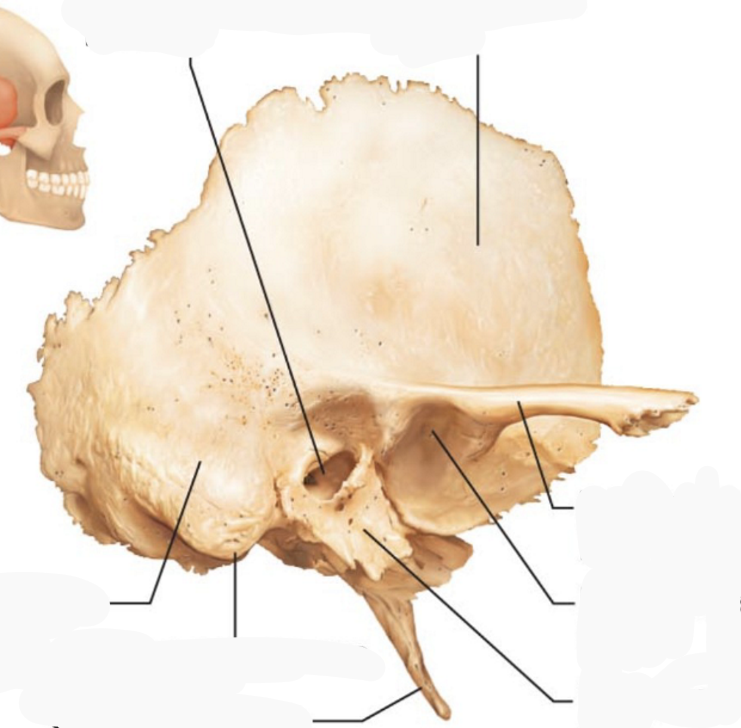 <p>Where in the picture is the petrous part of the temporal bone?</p>