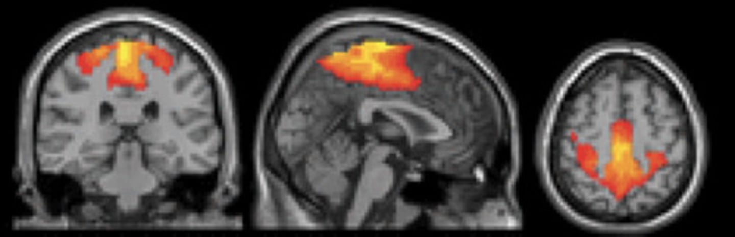 <p>- controls movement and perception</p>