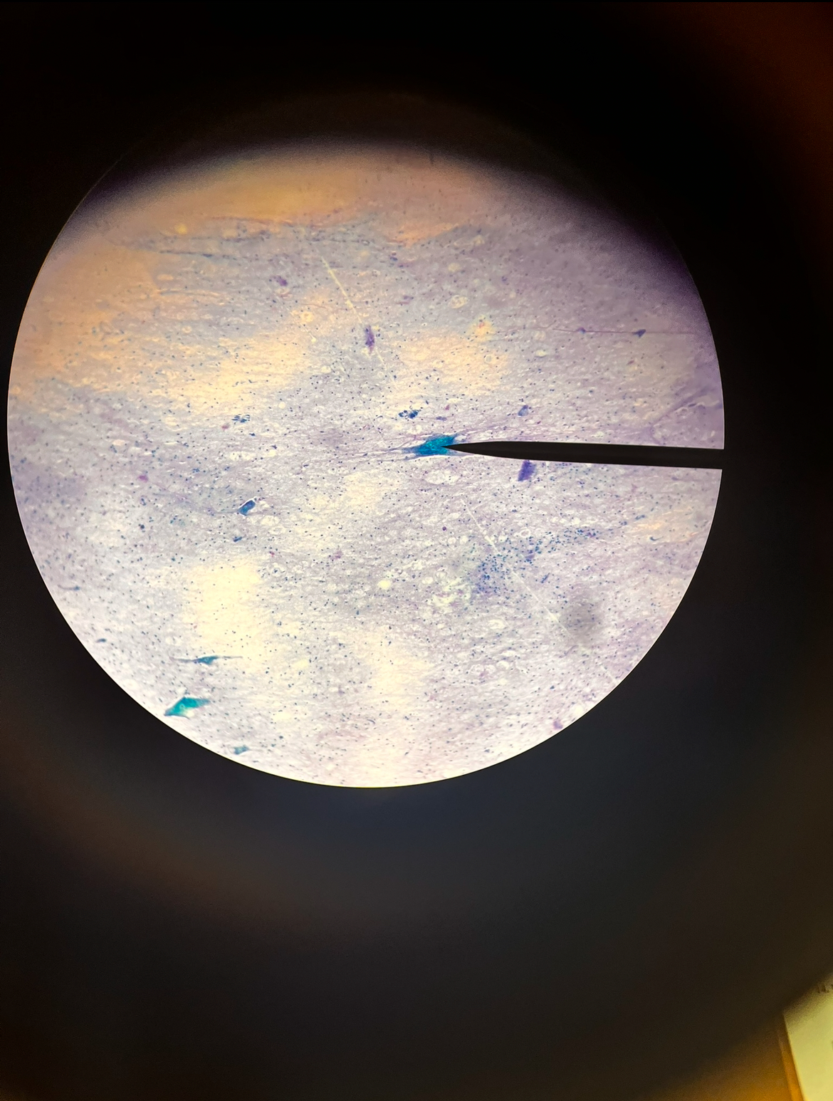 <p><span>Identify the tissue seen here.</span></p><p><span>Name the cell indicated by the pointer.</span></p>