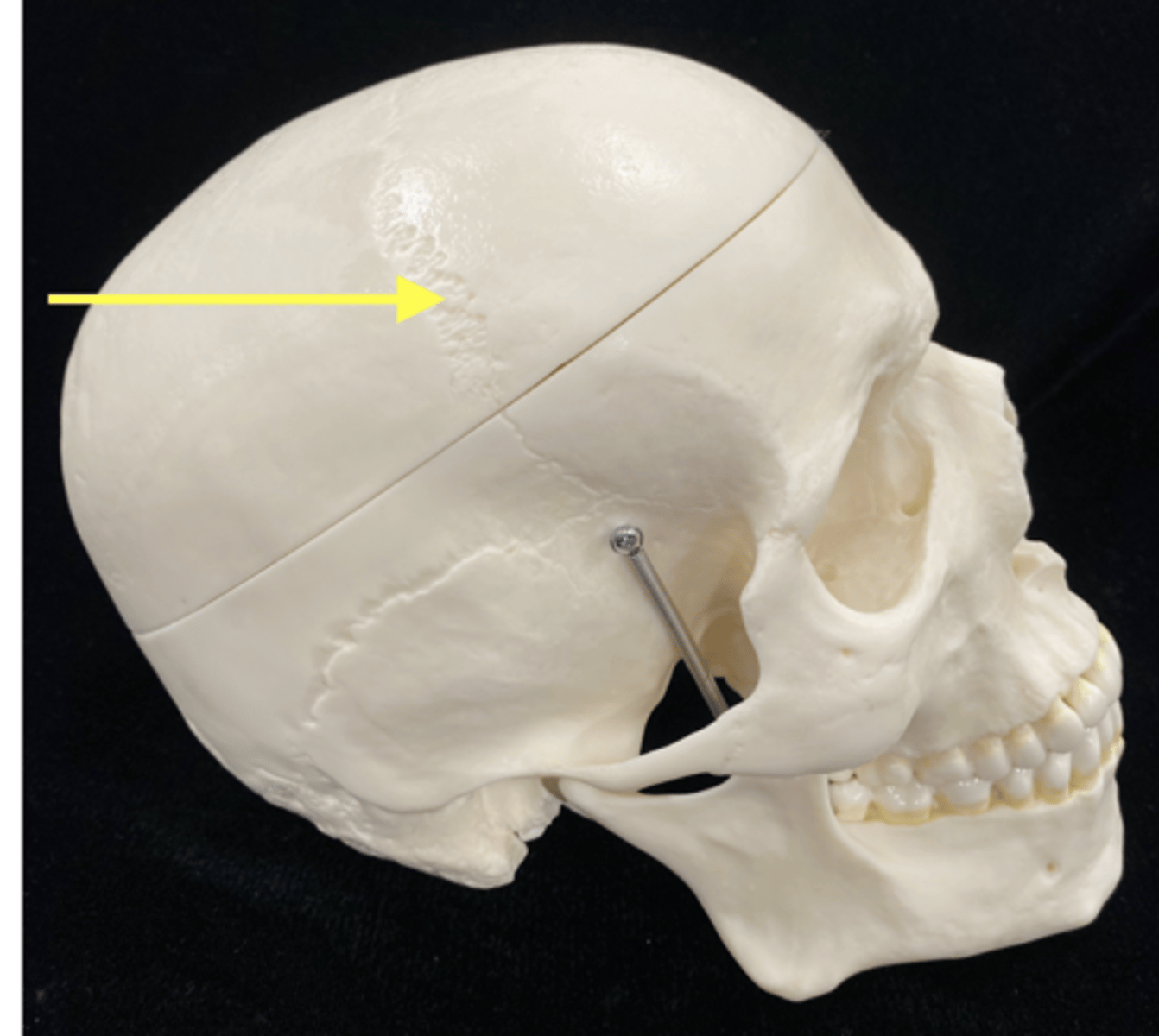 <p>name the suture</p>