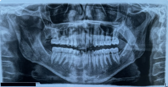term image