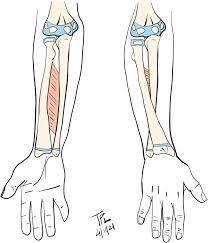 <p>fibrous joint (between ulna and radius)</p>