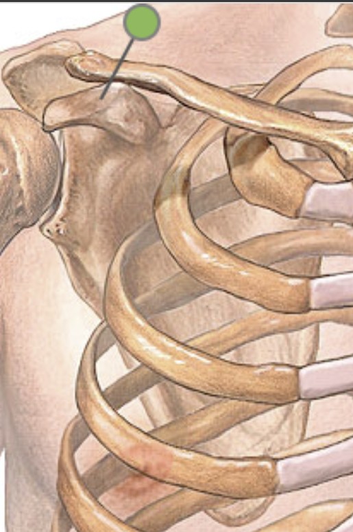 <p>Which bone landmark of the scapula looks like a crow’s beak and anterior to spine?</p>