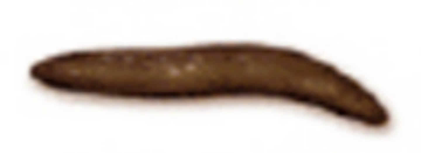 <p>like a smooth, soft, sausage or snake</p><p>- normal</p>
