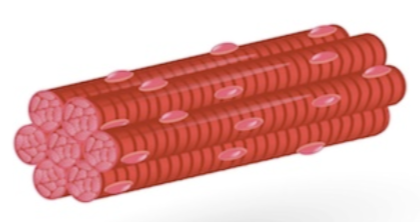 <p>What type of muscle is this?</p>