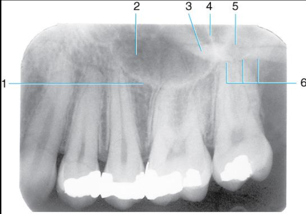 <p>Label the structures 1-6 of the Maxillary premolar area </p>