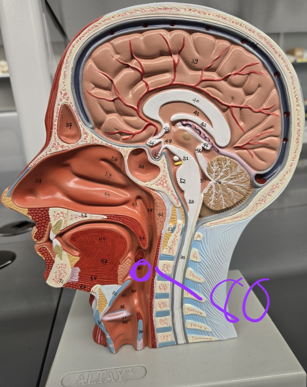 <p>Half head model: what structure is this?</p>