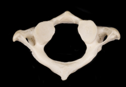 <p>which vertebrae is this</p>