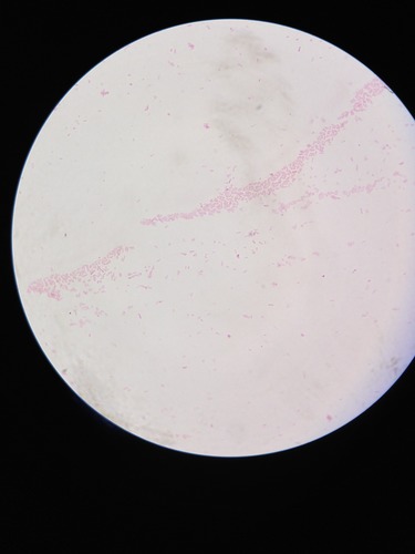Identify the gram reaction and shape