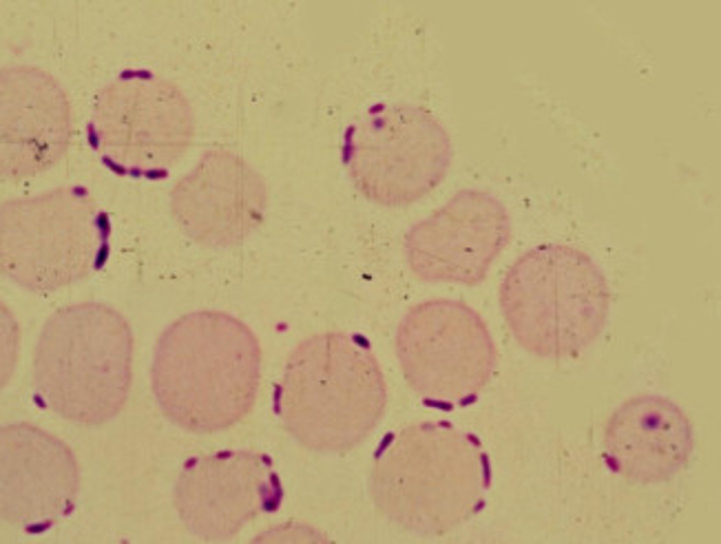 <p>- found on membrane</p><p>- may trigger immune response</p>