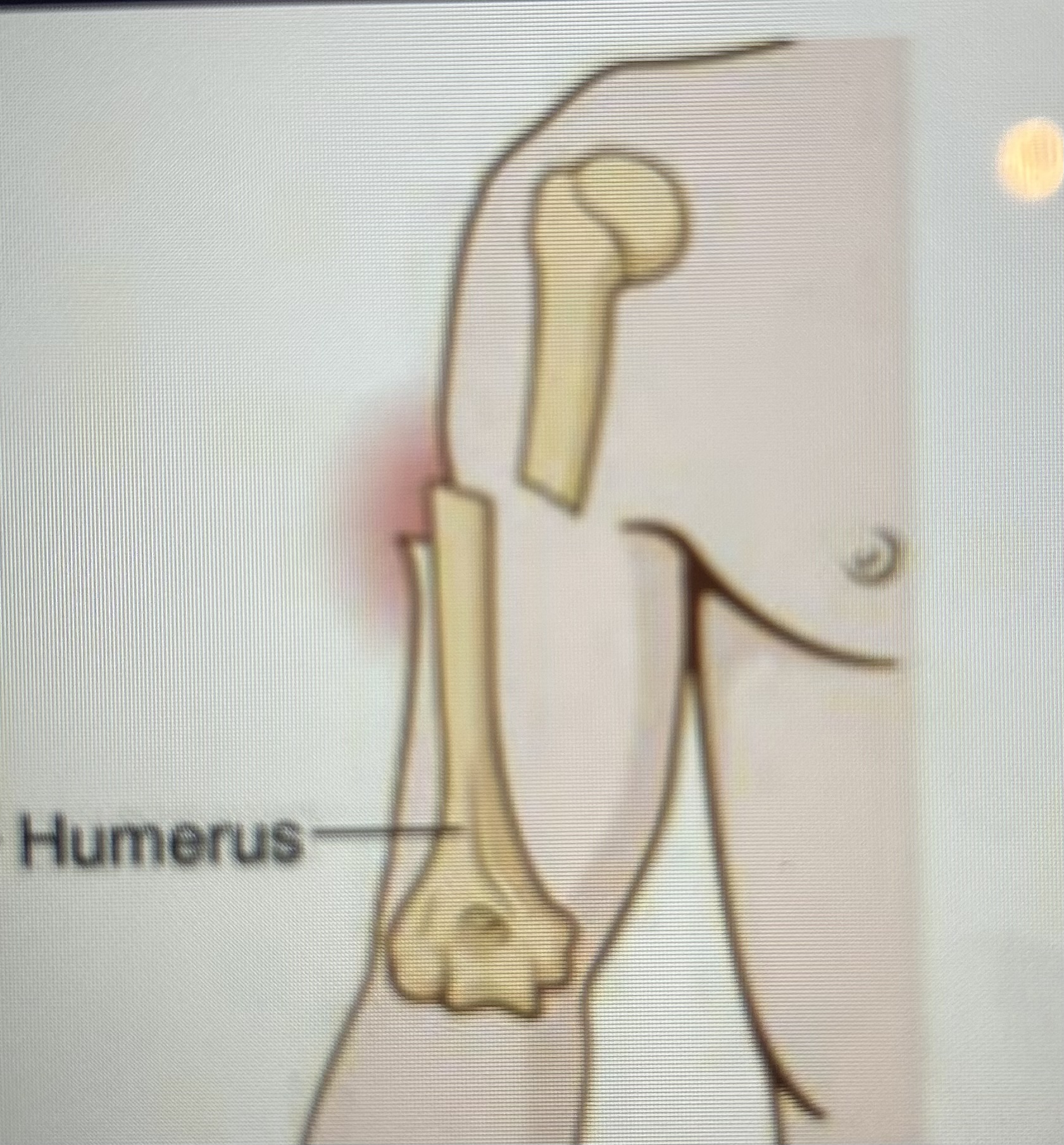 <p>What type of fracture is this?</p>
