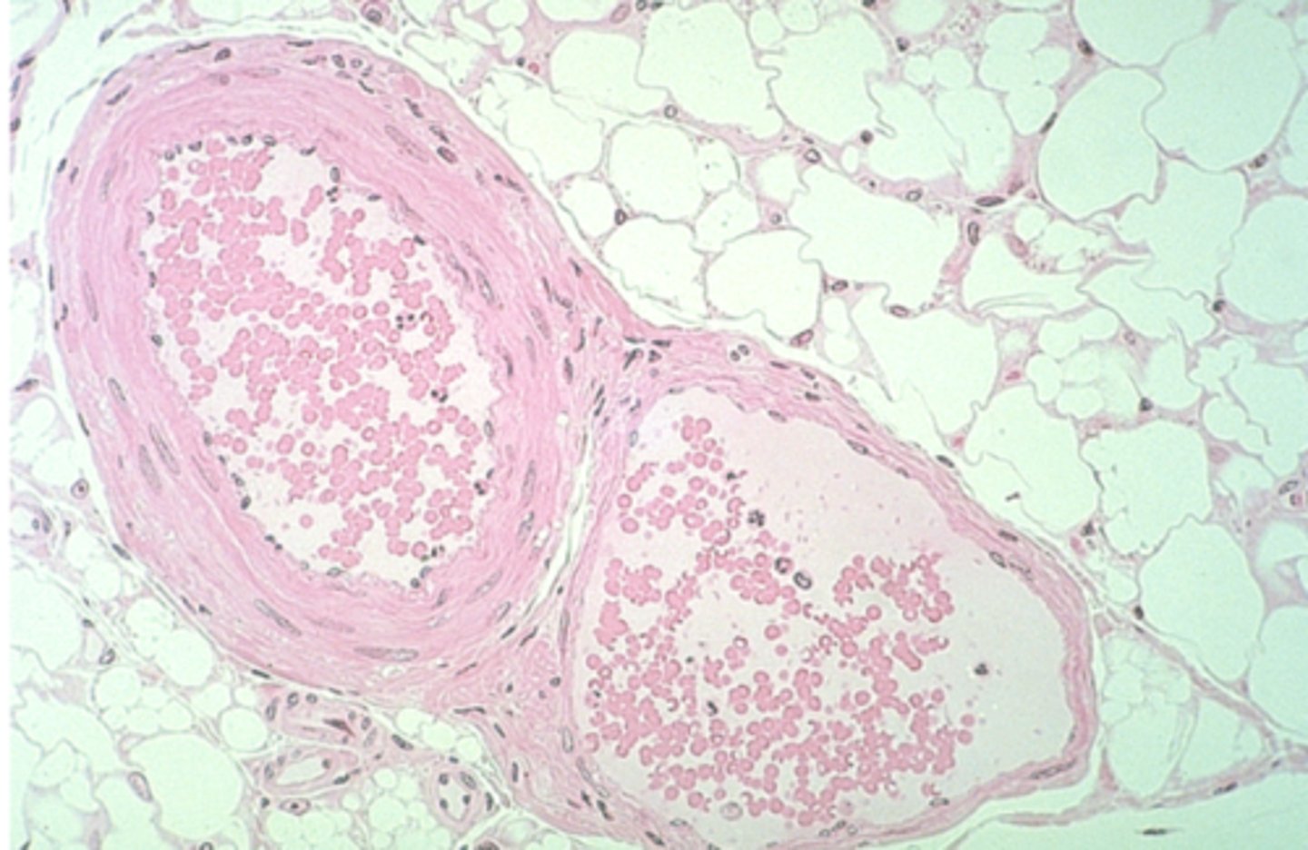 <p>How to identify a vein</p>