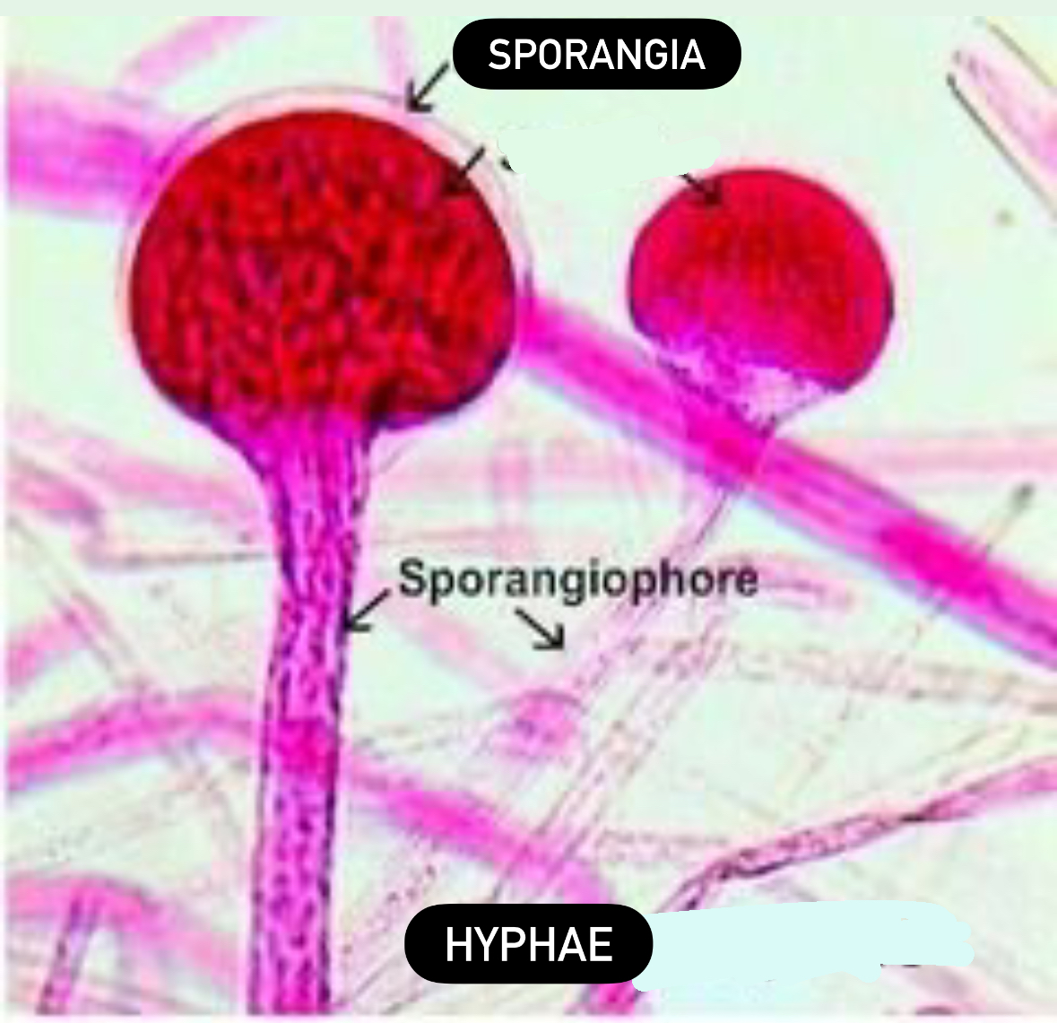<p>Sporangia</p><p>Haploid</p><p>Domain: Eukarya</p><p>Kingdom: Fungi</p><p>Clade: Mucoromycontina</p>