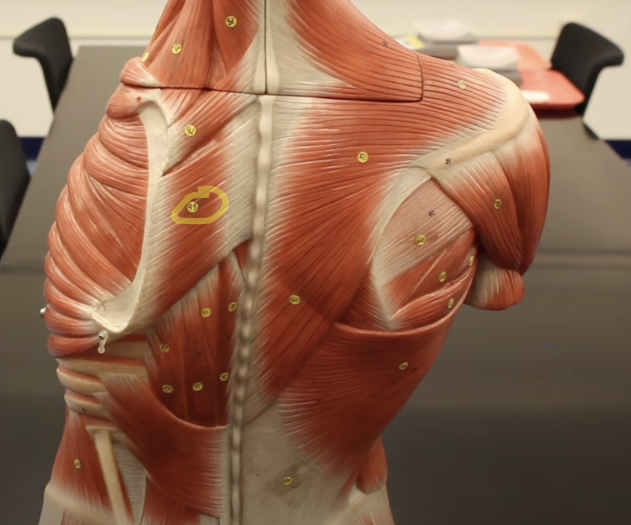 <p>What muscle is this?*****</p>