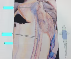 <p>posterior cardinal veins</p>