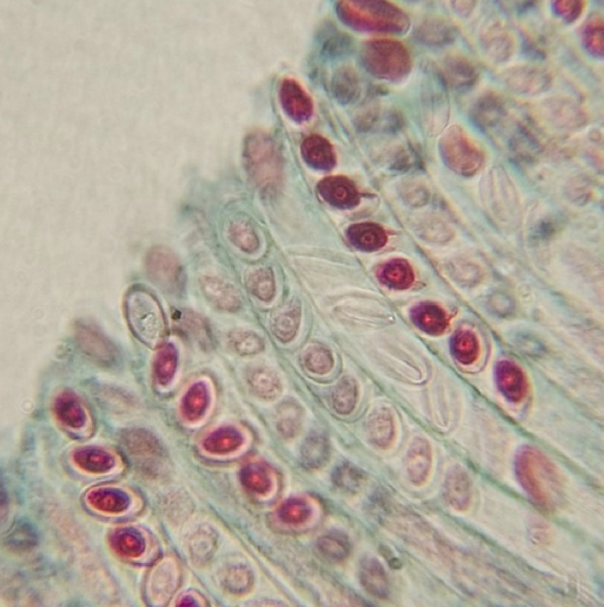 <p>the reproductive structure where 8 ascospores develop in ascomycetes</p>