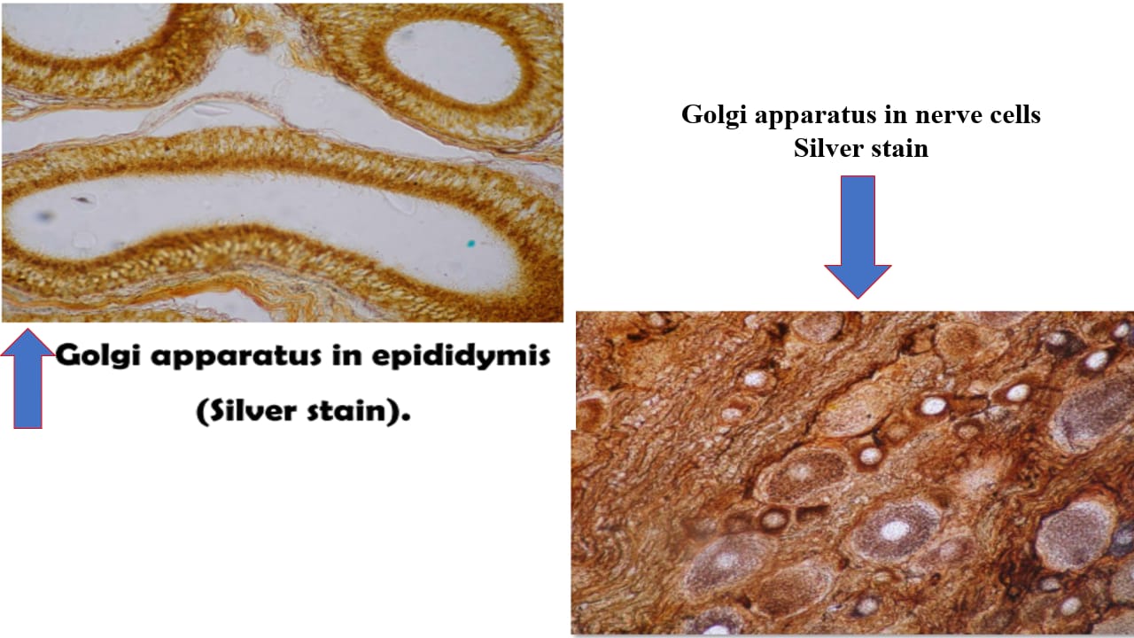 <p>Term 6</p>