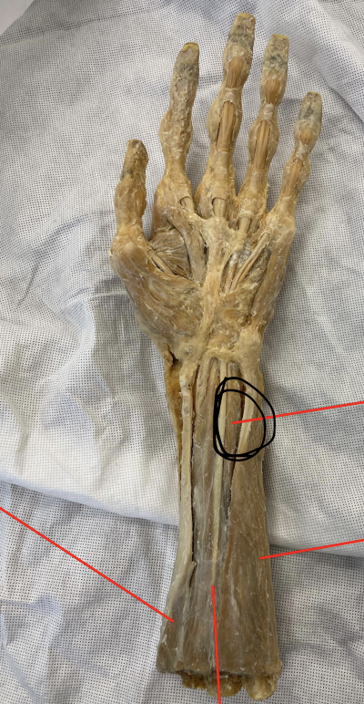 <p>identify + state origin, insertion, action, innervation of marked structure</p>