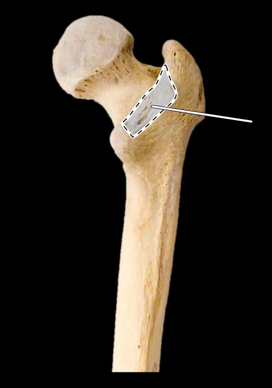 <p>Name the highlighted portion.</p><p>(Posterior view, right side).</p>