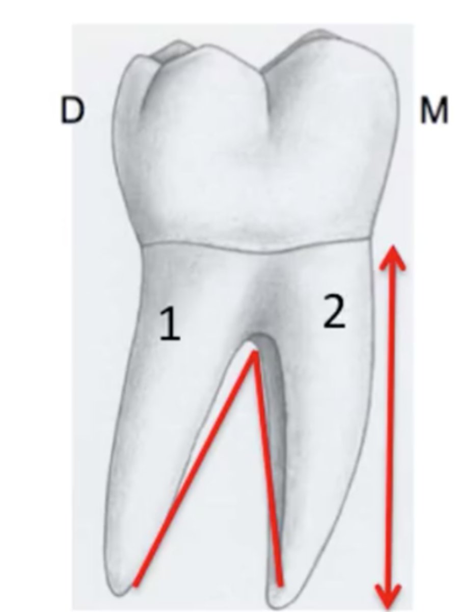 <p>mesial root</p>