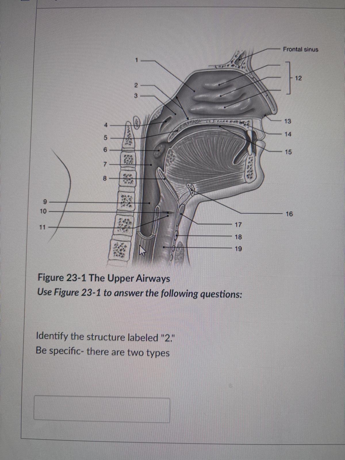 <p><span>Identify the structure labeled "2." Be specific- there are two types</span></p>