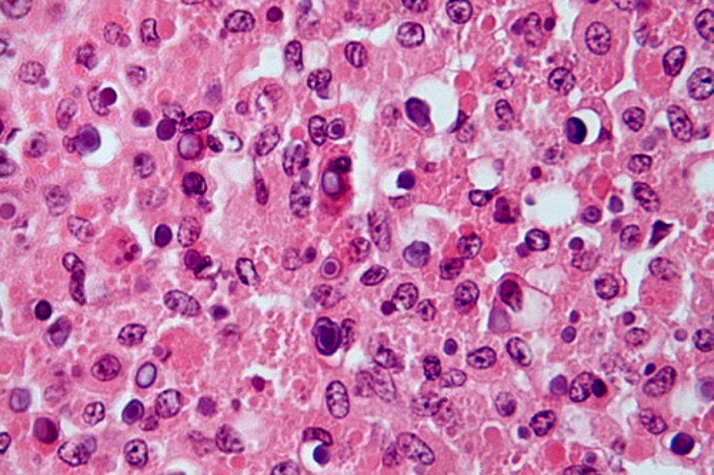 <p>Serves as the actual "trigger" for muscle contraction by removing the inhibition of the troponin molecules</p>