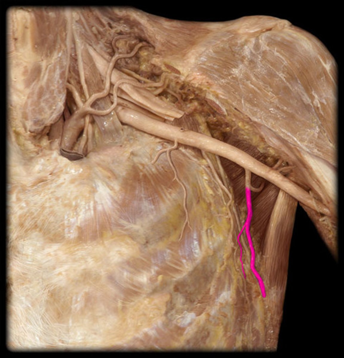 <p>descending with the thoracodorsal nerve to enter the apex of lat</p>