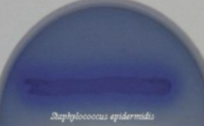 <p>Is this a negative or positive Lipid hydrolysis (Sprit blue agar) test?</p>