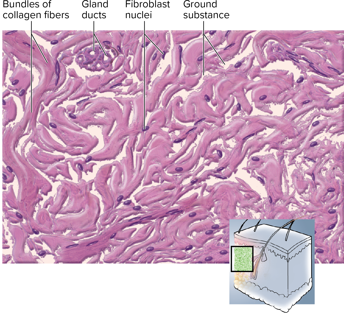 <p><strong>dermis of skin</strong></p><p>→ can get pulled in many directions </p>