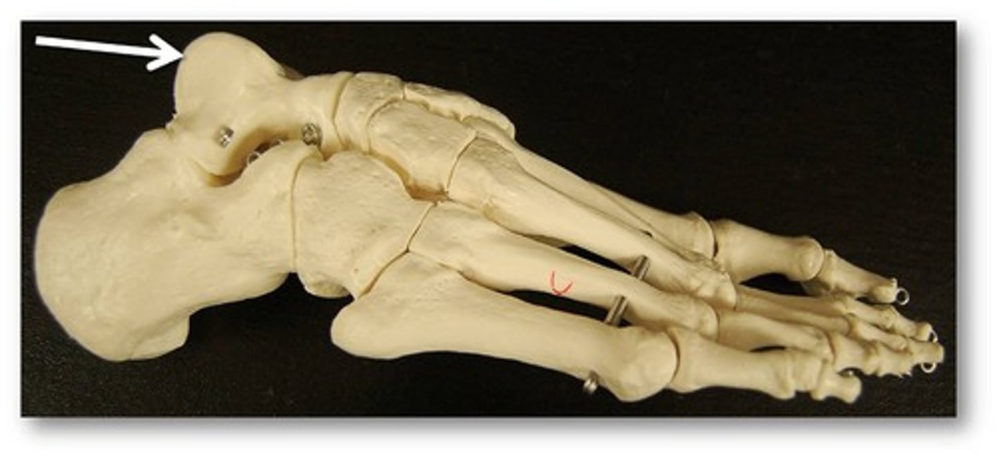 <p>Name this specific bone of the foot.</p>