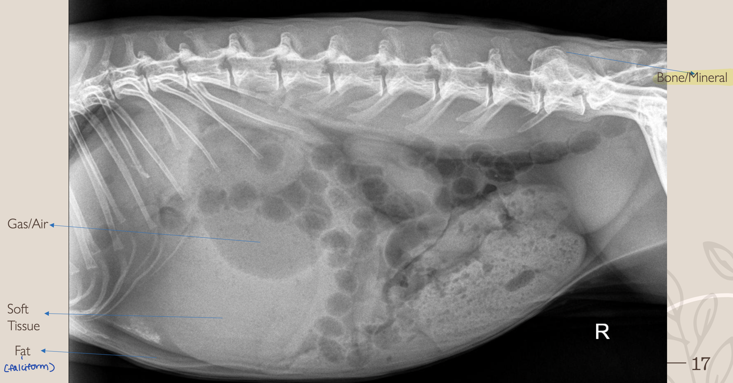 <p>Soft Tissue </p>
