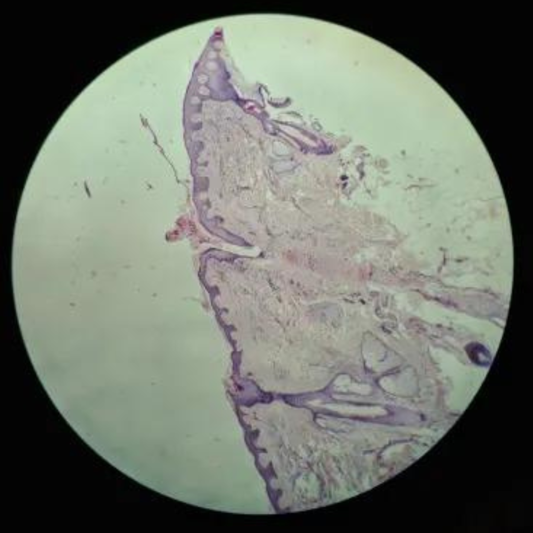 term image