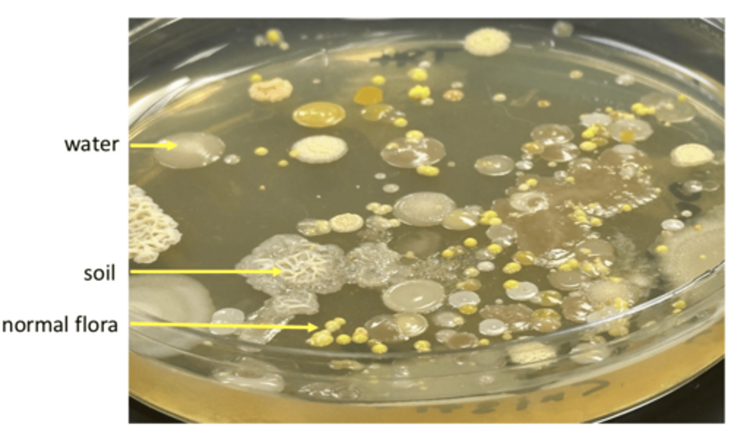 <p>glossy colonies = water</p><p>rough, whitish colonies = soil</p><p>yellow or whitish colonies = normal flora</p>