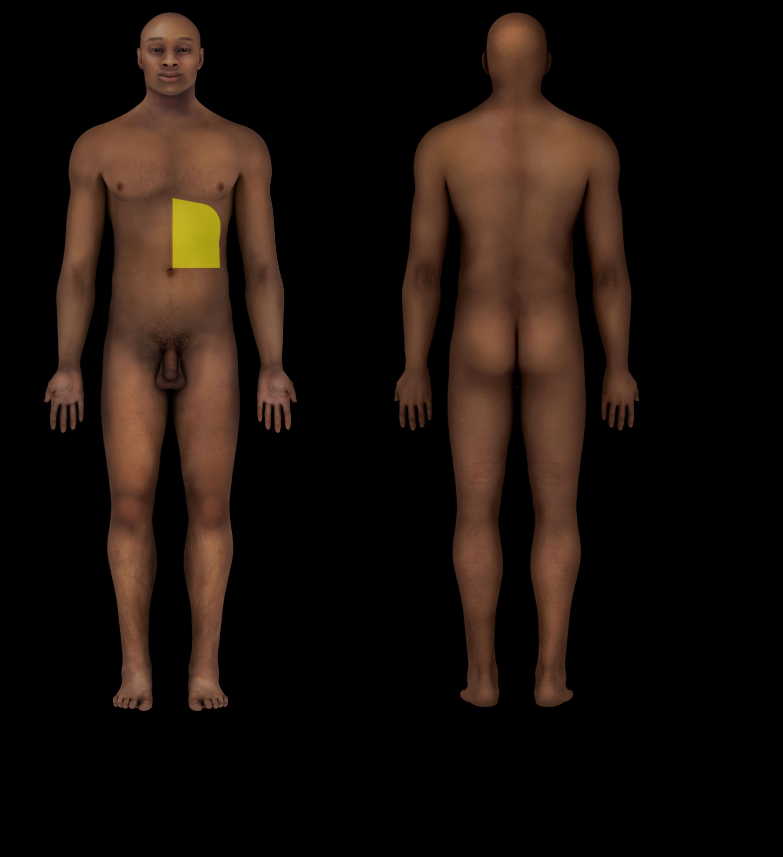 term image