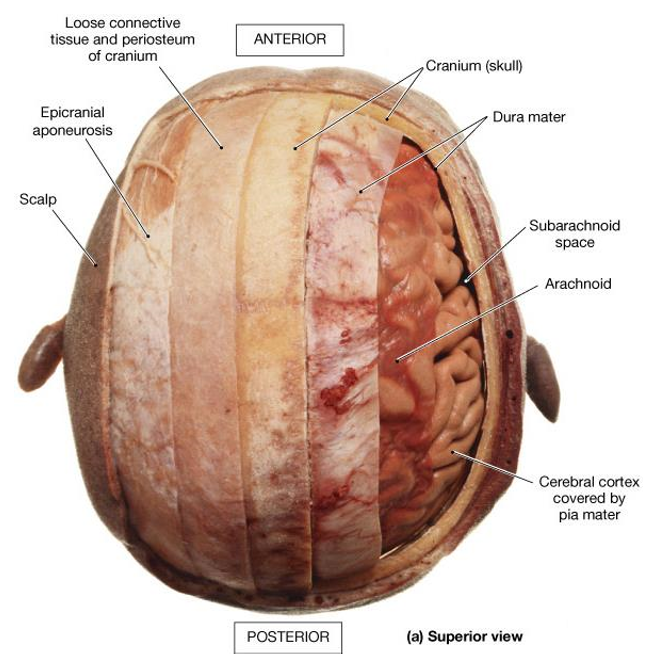 <p>Dura mater- tough fibrous membranes</p><ul><li><p>Falx cerebri, tentorium cerebelli- adhere to the skull, contains folds that separate the lobes of the brain, surrounds CNS and SC, ensures tight fit to prevent movement of brain</p></li></ul><p>Arachnoid mater- soft translucent, avascular</p><p>Subarachnoid space- contains CSF produced from choroid plexus</p><p>Pia mater- microscopically small and highly vascular</p><p></p>