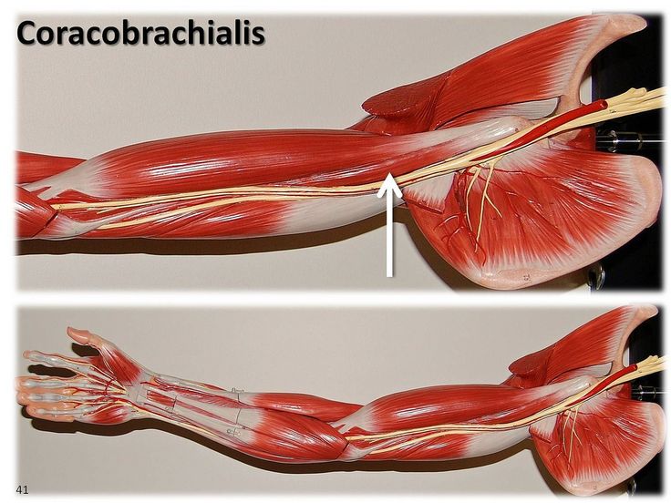 <p>coracobrachialis – action</p>