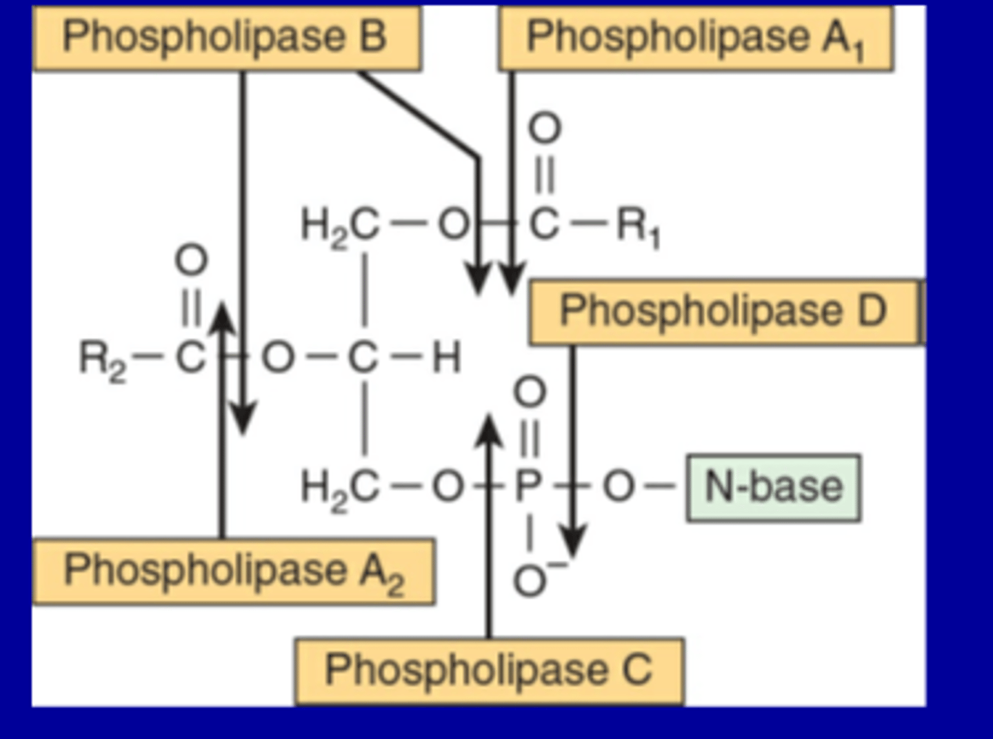 <p>Phospholipase A₁ (PLA₁):</p><p>Cleaves the ester bond at the first carbon of glycerol.</p><p>Releases the fatty acid at position 1.</p><p>Phospholipase A₂ (PLA₂):</p><p>Cleaves the ester bond at the second carbon of glycerol.</p><p>Releases the fatty acid at position 2.</p><p>Important in inflammatory responses (e.g., arachidonic acid release).</p><p>Phospholipase B (PLB):</p><p>Can act on both positions 1 and 2, removing both fatty acids.</p><p>Phospholipase C (PLC):</p><p>Cleaves before the phosphate group, releasing diacylglycerol (DAG) and the phosphorylated head group.</p><p>Plays a role in signal transduction.</p><p>Phospholipase D (PLD):</p><p>Cleaves after the phosphate group, releasing phosphatidic acid and the free head group.</p><p>Also involved in cell signaling.</p>