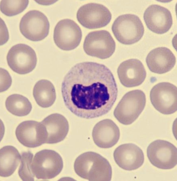 <p>What is this neutrophil showing?</p>