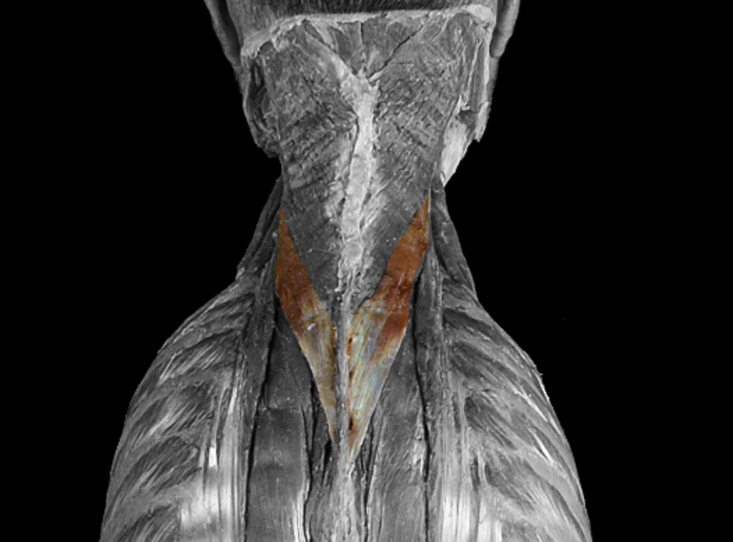 <p>What muscle is this?</p>