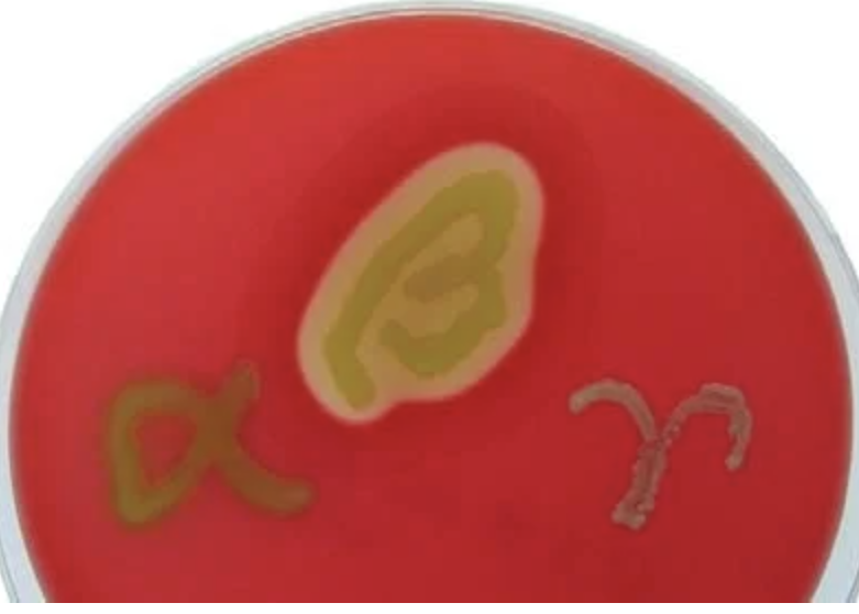 <p>What test is this?</p>