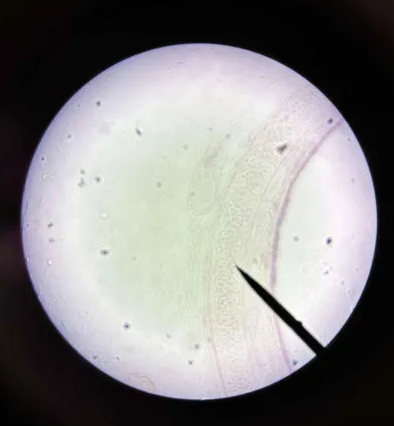 <p>Where is this tissue from?</p>
