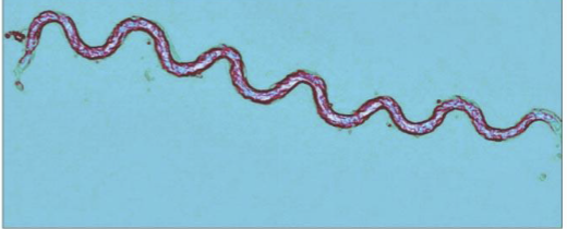 <p>What type of Bacteria is this, and why is it special?</p>