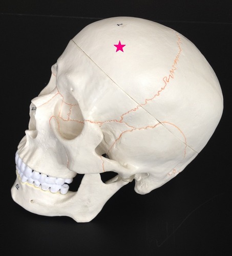 <p>Identify the bone.</p>