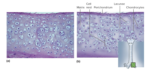 <p>Hyaline cartilage</p>