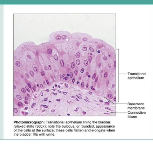 <p>transitional location</p>